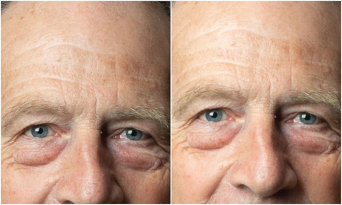 Diptych photo showing the difference between setting the white point. and original image in Photoshop portrait editing