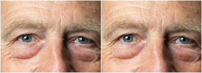 Portrait detail diptych Before and After the eye sharpening on Photoshop