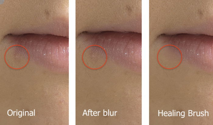 Triptych comparison of two methods of retouching blemishes in Photoshop