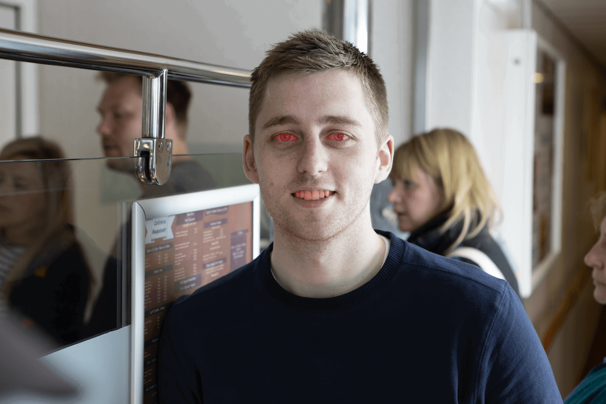 photograph of a man with his eyes and teeth masked