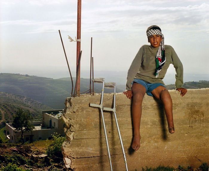 Young teen with leg missing sitting on wall in Hebron, Palestine